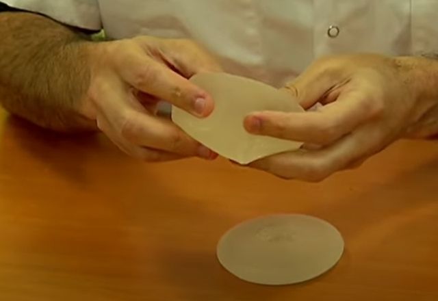 Mulheres estão reduzindo tamanho do silicone no peito | Reprodução