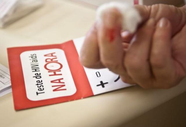 AIDS: a epidemia dentro da pandemia da covid chega a 2022 AIDS: a epidemia dentro da pandemia da covid chega a 2022