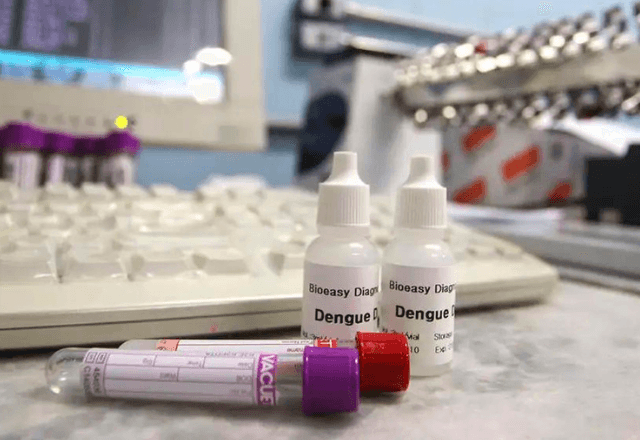 Novos tipos de testes permitirão uma esposta mais rápida no controle da epidemia, segundo a Anvisa