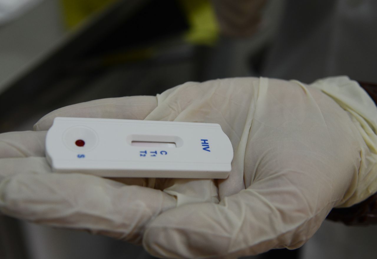 Teste de HIV | Rovena Rosa/Agência Brasil