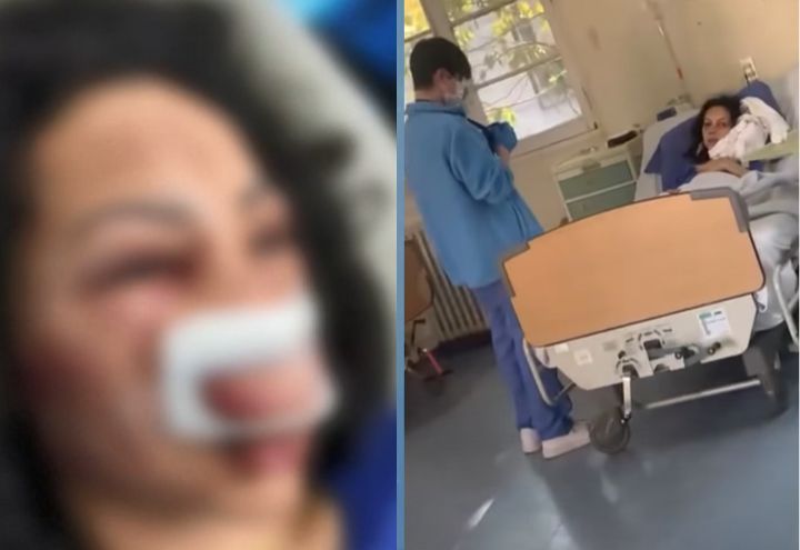 Turista brasileira espancada no Chile recebe alta médica