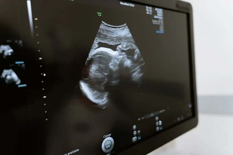 PL quer equiparar aborto a homicídio mesmo em caso de estupro, quando é permitido por lei. | Pexels